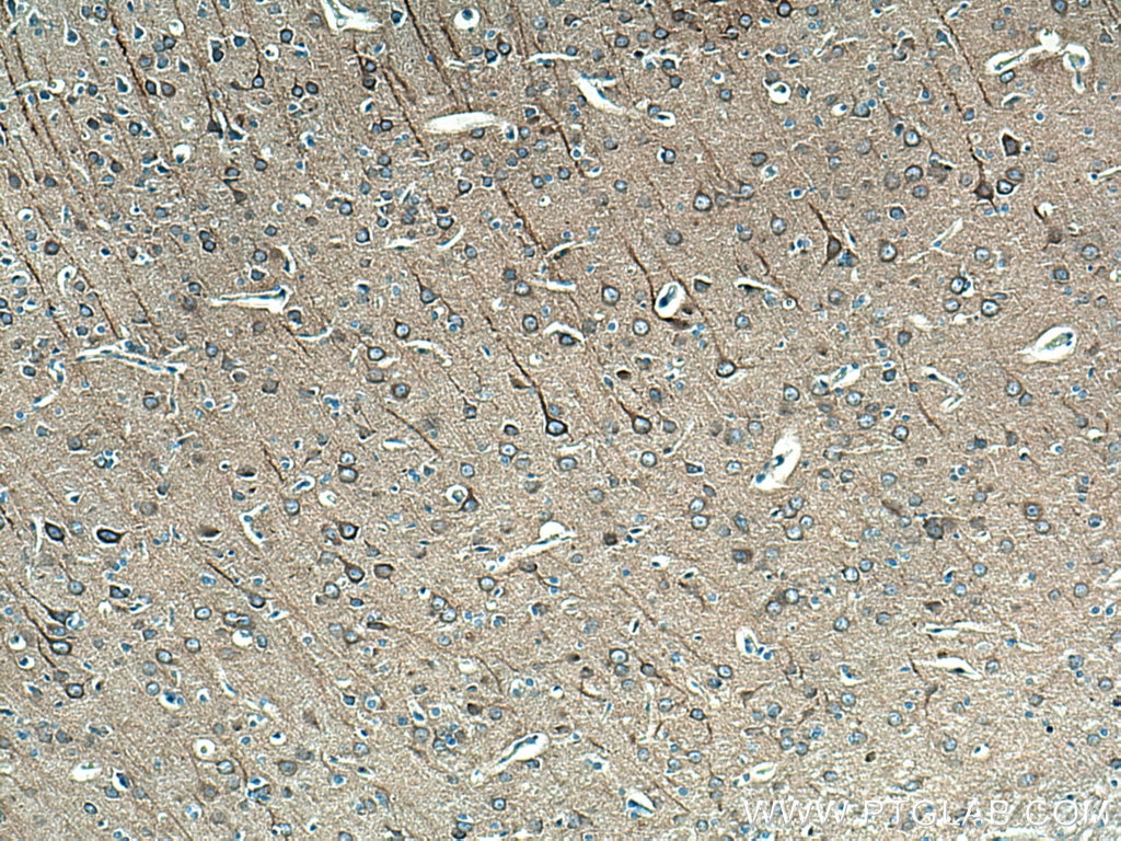 Immunohistochemistry (IHC) staining of rat brain tissue using Beta Tubulin Polyclonal antibody (10068-1-AP)