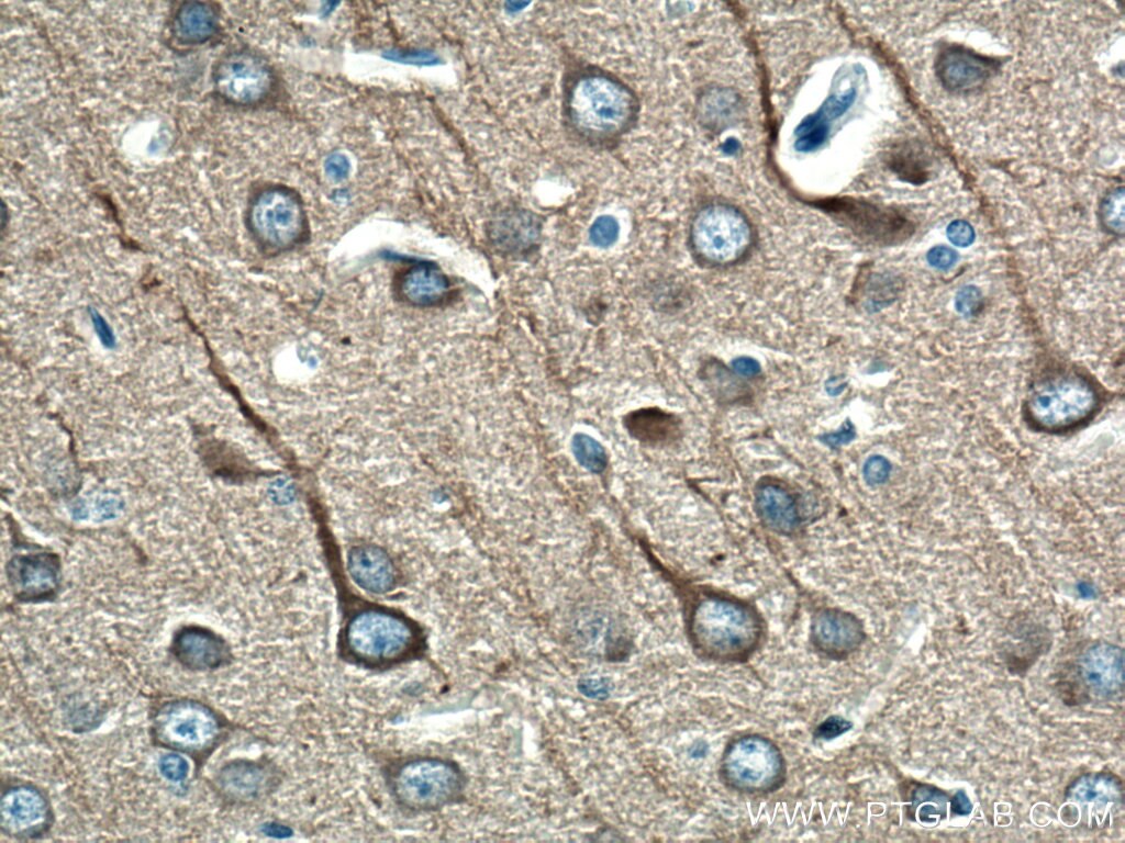 Immunohistochemistry (IHC) staining of rat brain tissue using Beta Tubulin Polyclonal antibody (10068-1-AP)