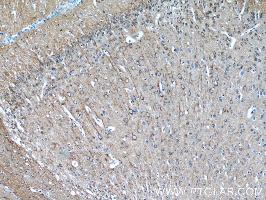 Immunohistochemistry (IHC) staining of mouse brain tissue using Beta Tubulin Polyclonal antibody (10068-1-AP)