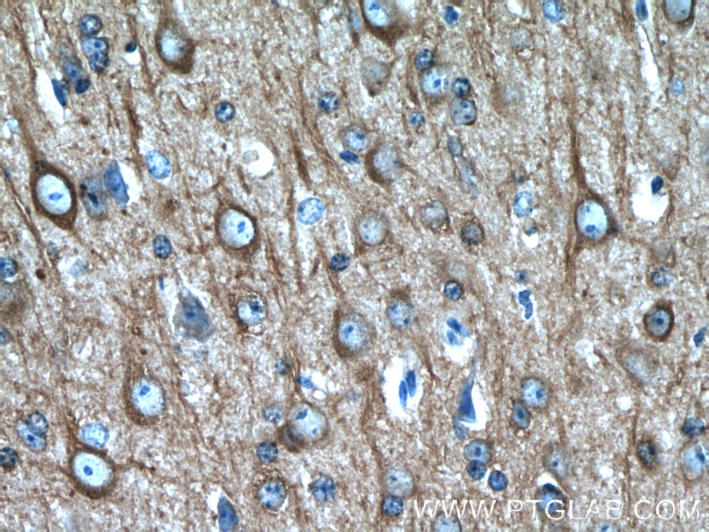 Immunohistochemistry (IHC) staining of mouse brain tissue using Beta Tubulin Polyclonal antibody (10068-1-AP)