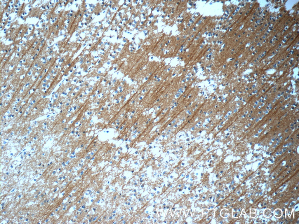 Immunohistochemistry (IHC) staining of human brain tissue using Beta Tubulin Polyclonal antibody (10068-1-AP)