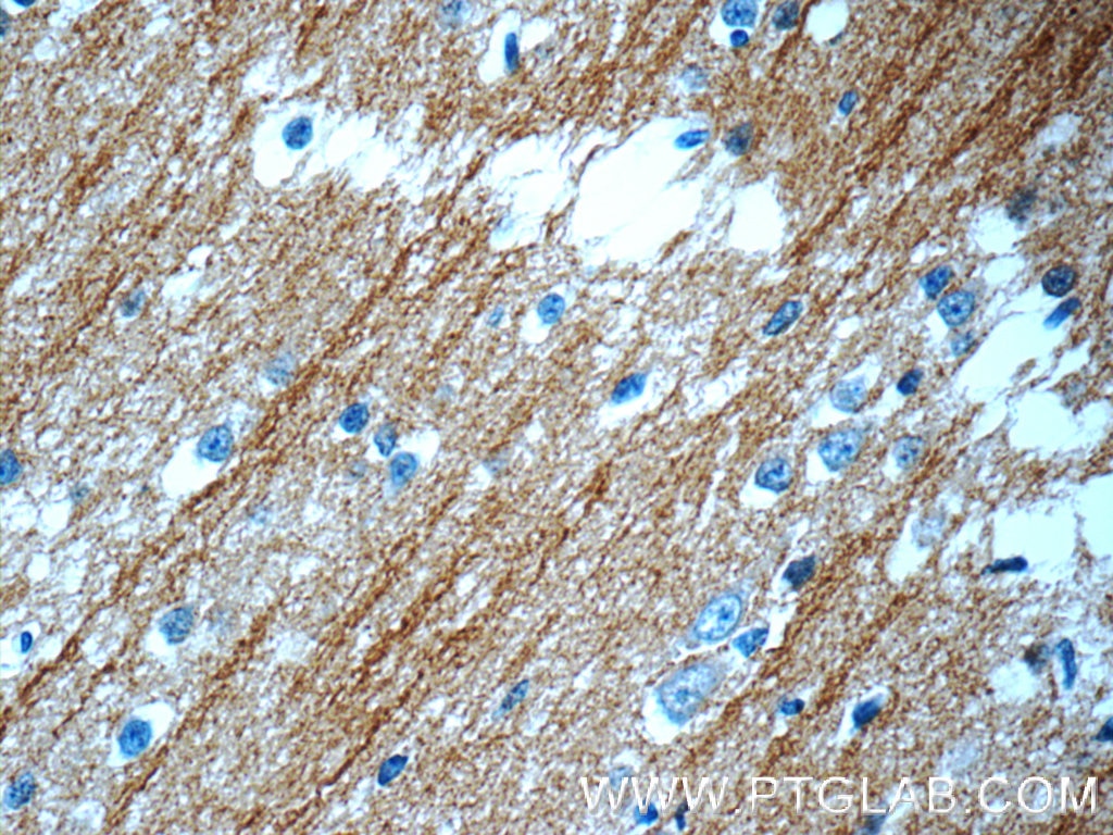 Immunohistochemistry (IHC) staining of human brain tissue using Beta Tubulin Polyclonal antibody (10068-1-AP)