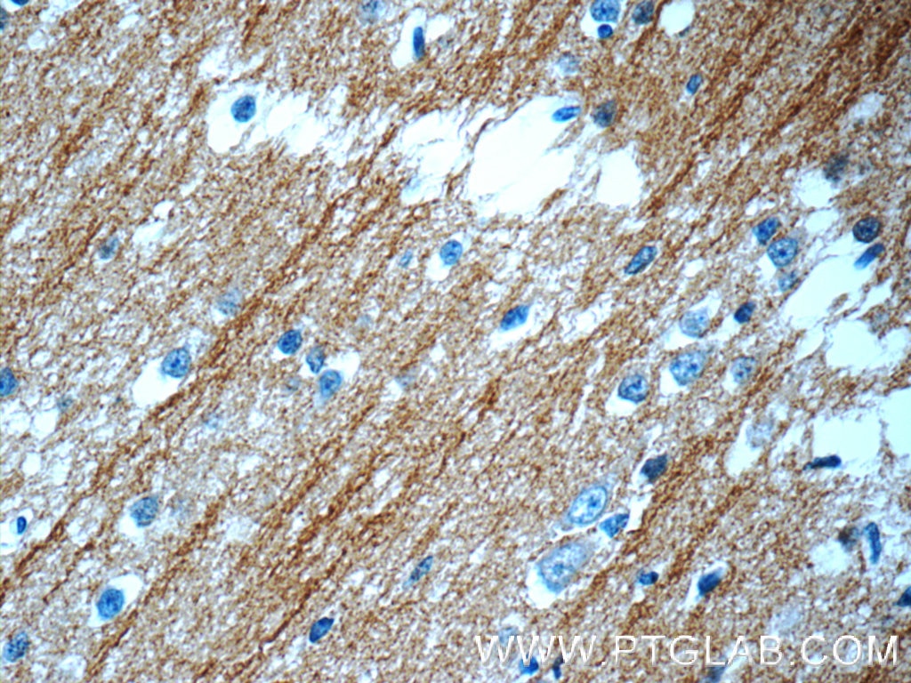 IHC staining of human brain using 10068-1-AP