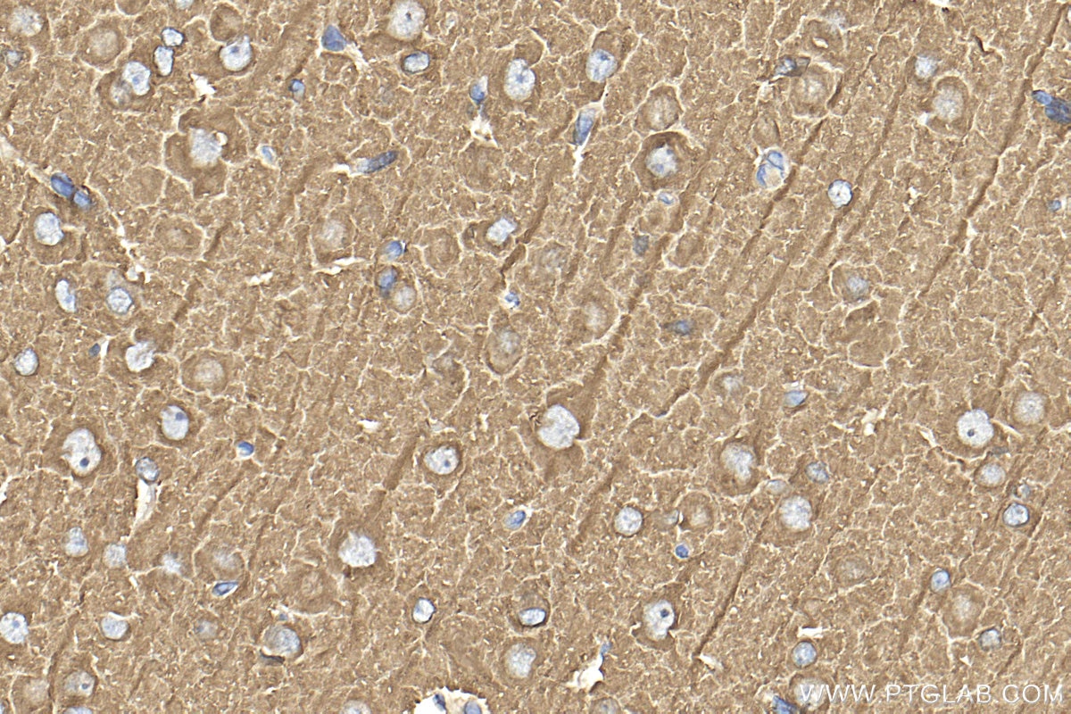 Immunohistochemistry (IHC) staining of rat brain tissue using Beta Tubulin Polyclonal antibody (10068-1-AP)