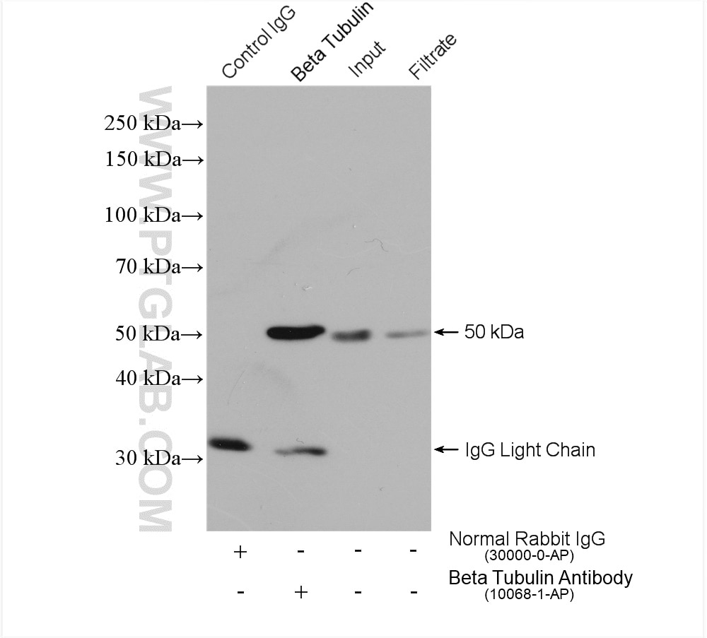 Immunoprecipitation (IP) experiment of HEK-293 cells using Beta Tubulin Polyclonal antibody (10068-1-AP)