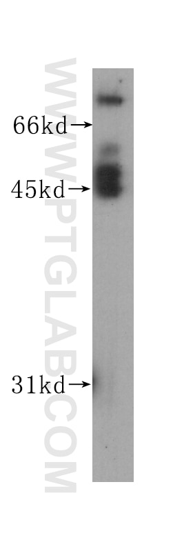 Western Blot (WB) analysis of human brain tissue using Beta Tubulin Monoclonal antibody (60039-1-Ig)