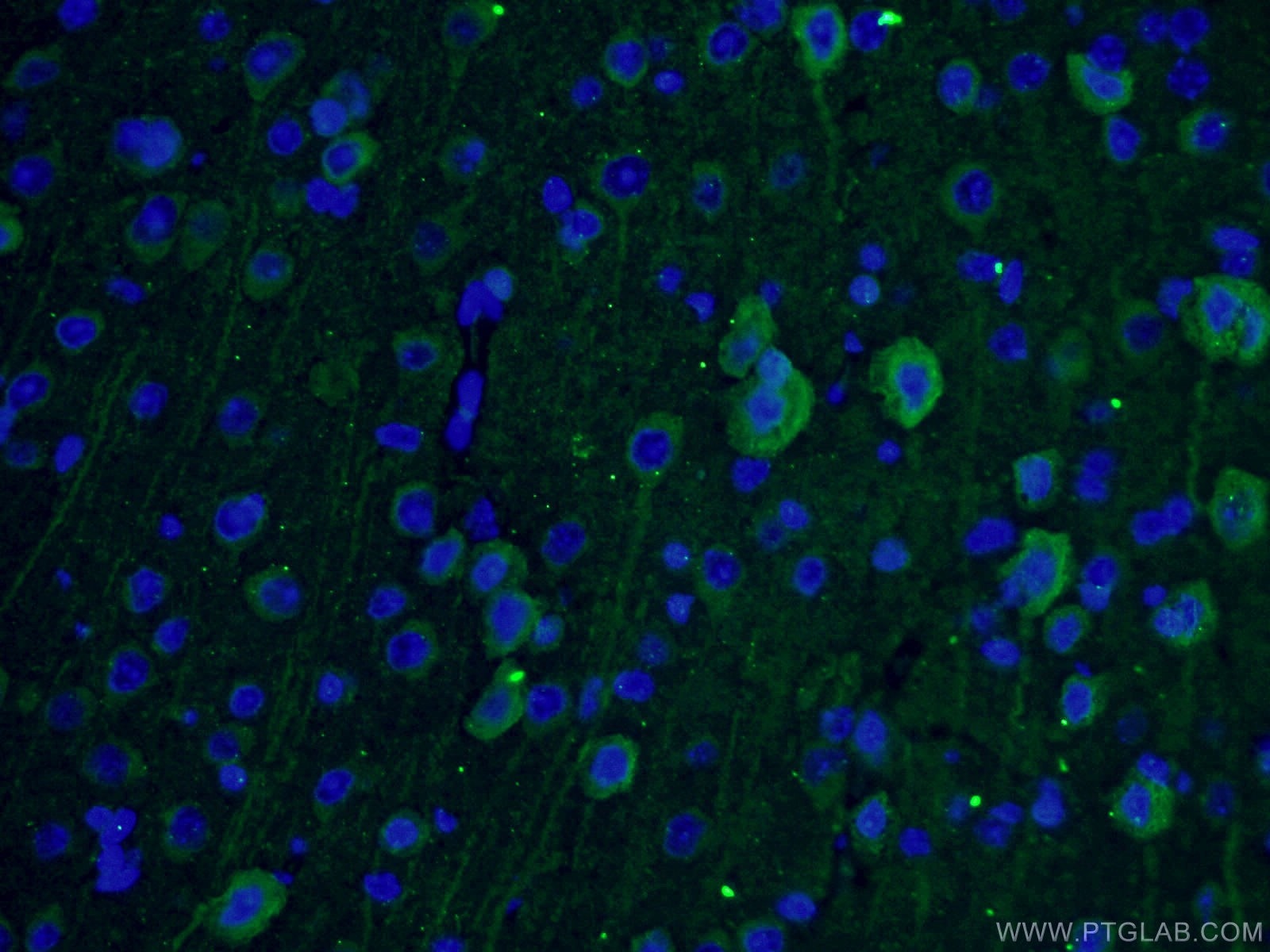 Immunofluorescence (IF) / fluorescent staining of mouse brain tissue using TUBB3-specific Monoclonal antibody (66375-1-Ig)
