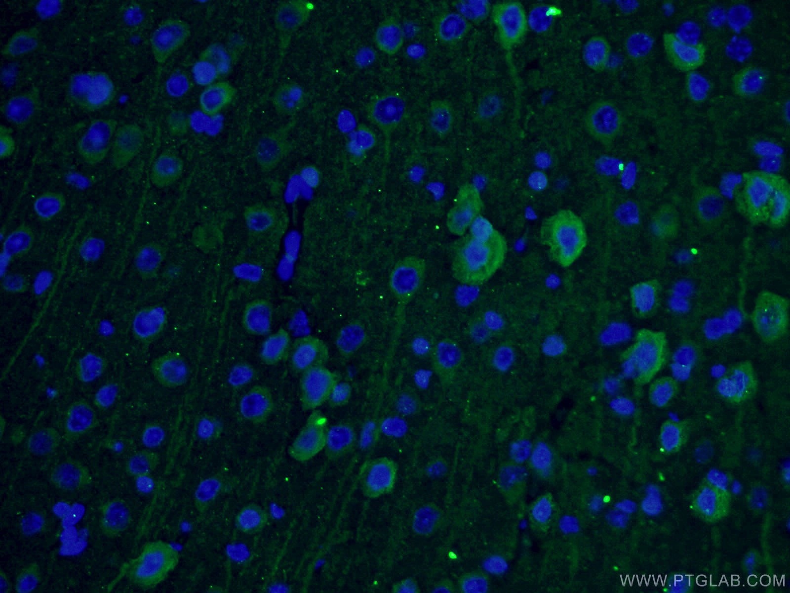 Immunofluorescence (IF) / fluorescent staining of mouse brain tissue using TUBB3-specific/TUJ1 Monoclonal antibody (66375-1-Ig)