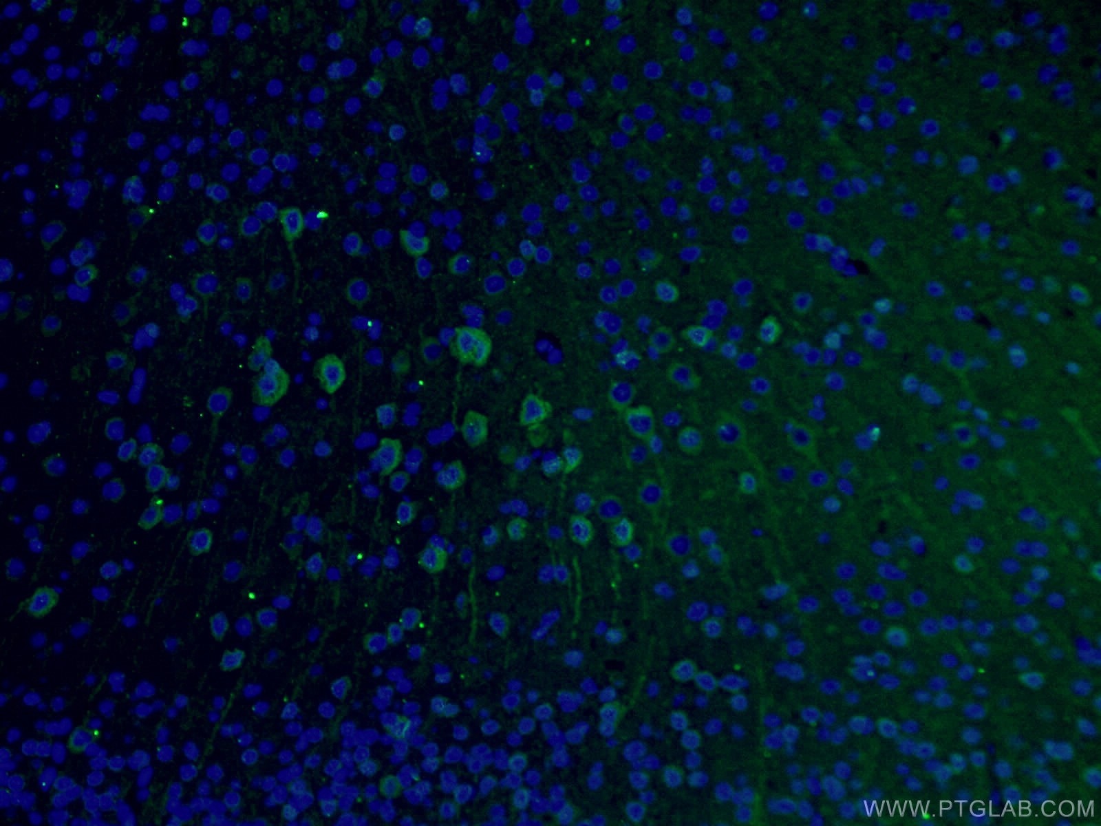 Immunofluorescence (IF) / fluorescent staining of mouse brain tissue using TUBB3-specific/TUJ1 Monoclonal antibody (66375-1-Ig)