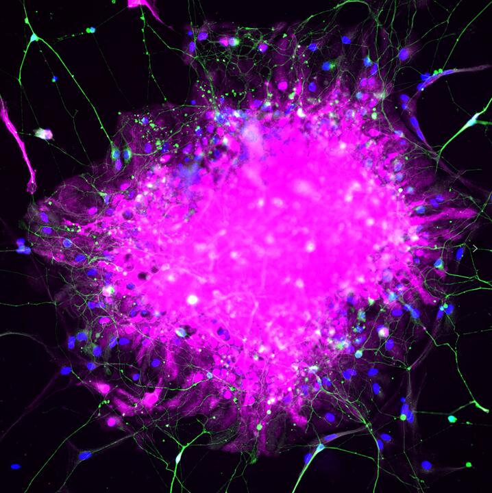 Immunofluorescence (IF) / fluorescent staining of human neuron using TUBB3-specific/TUJ1 Monoclonal antibody (66375-1-Ig)