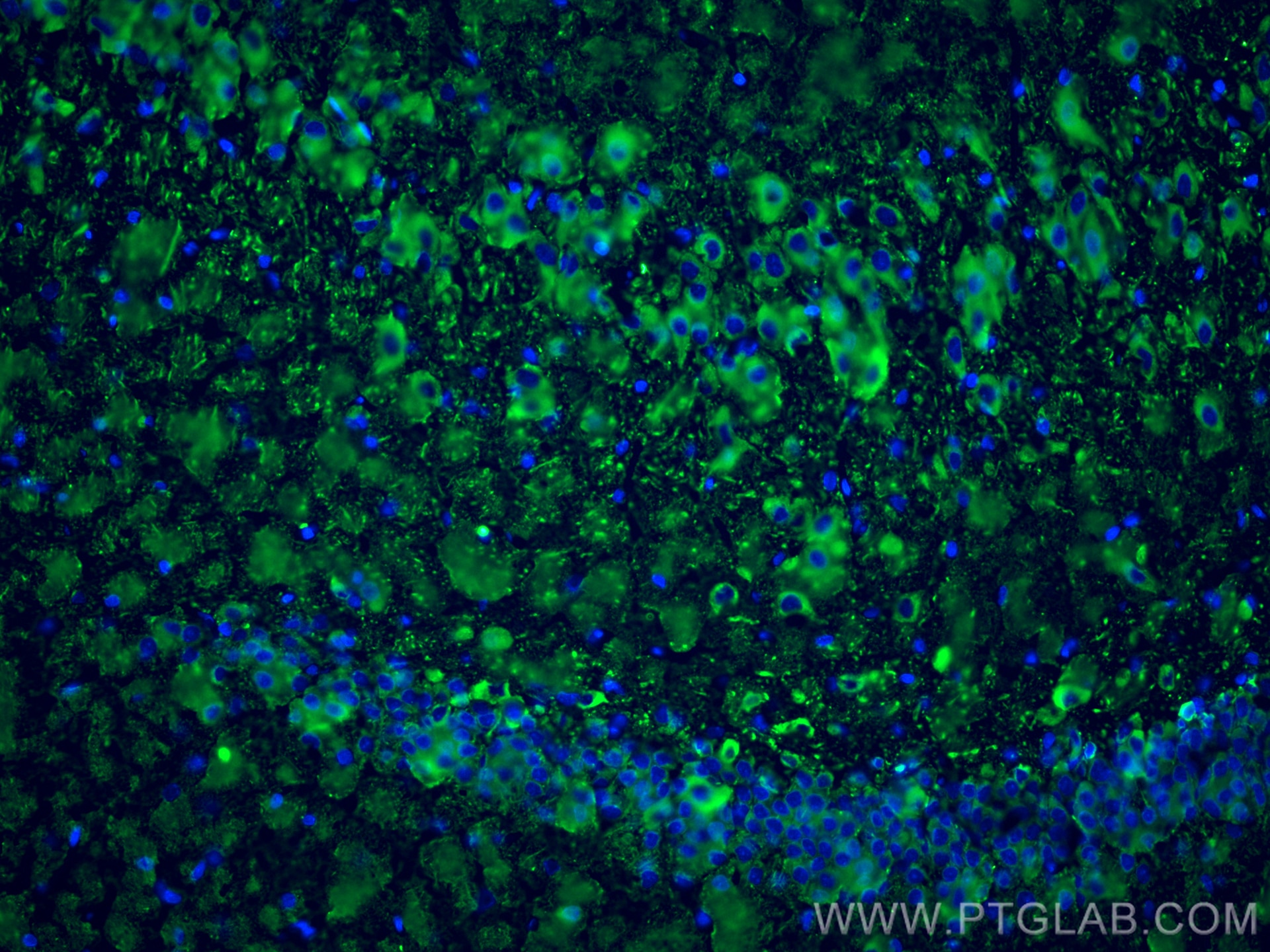 Immunofluorescence (IF) / fluorescent staining of rat brain tissue using TUBB3-specific/TUJ1 Monoclonal antibody (66375-1-Ig)