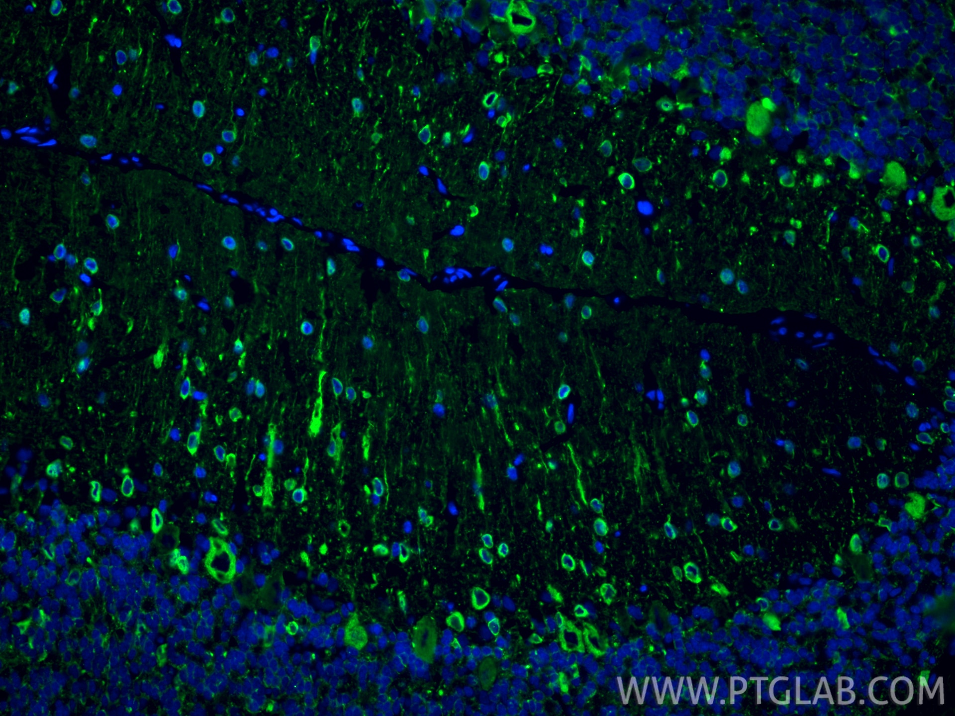 Immunofluorescence (IF) / fluorescent staining of rat cerebellum tissue using TUBB3-specific/TUJ1 Monoclonal antibody (66375-1-Ig)