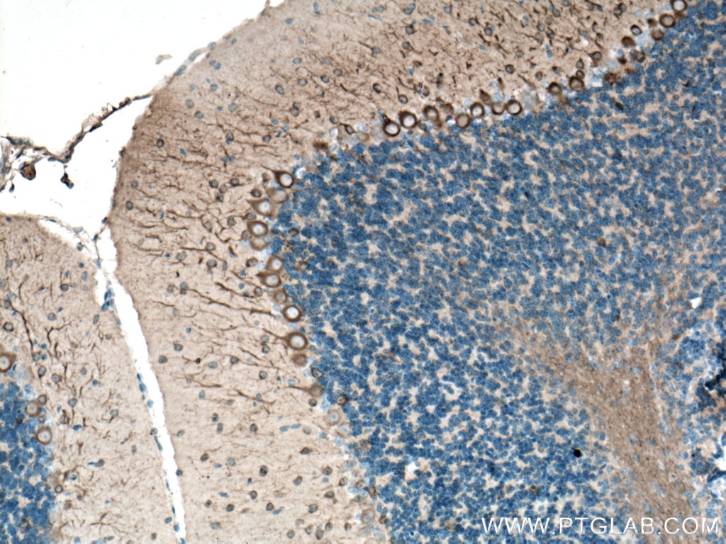 Immunohistochemistry (IHC) staining of mouse brain tissue using TUBB3-specific/TUJ1 Monoclonal antibody (66375-1-Ig)