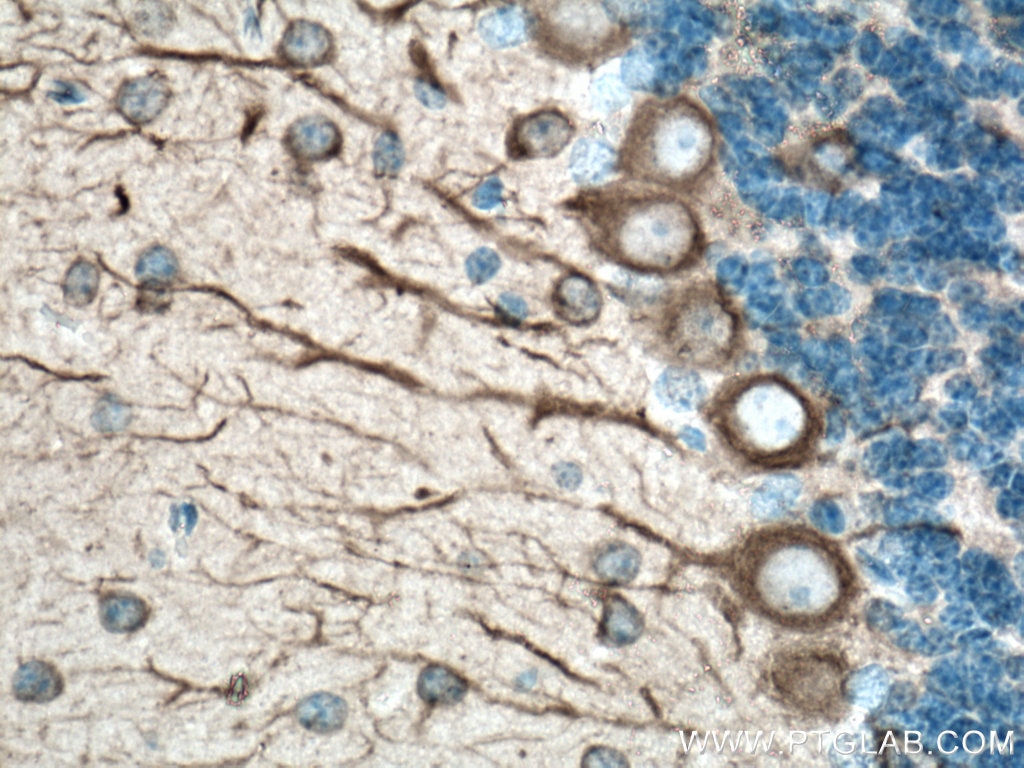 Immunohistochemistry (IHC) staining of mouse brain tissue using TUBB3-specific Monoclonal antibody (66375-1-Ig)