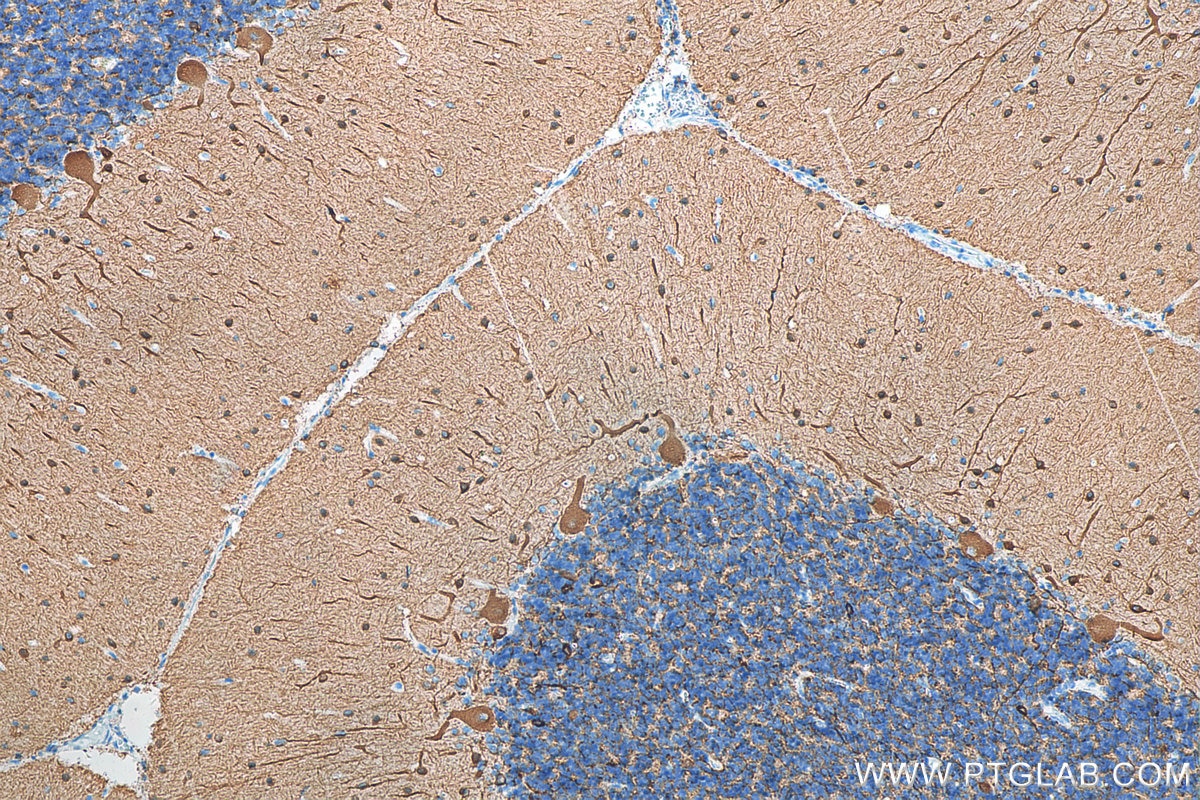 Immunohistochemistry (IHC) staining of human cerebellum tissue using TUBB3-specific/TUJ1 Monoclonal antibody (66375-1-Ig)