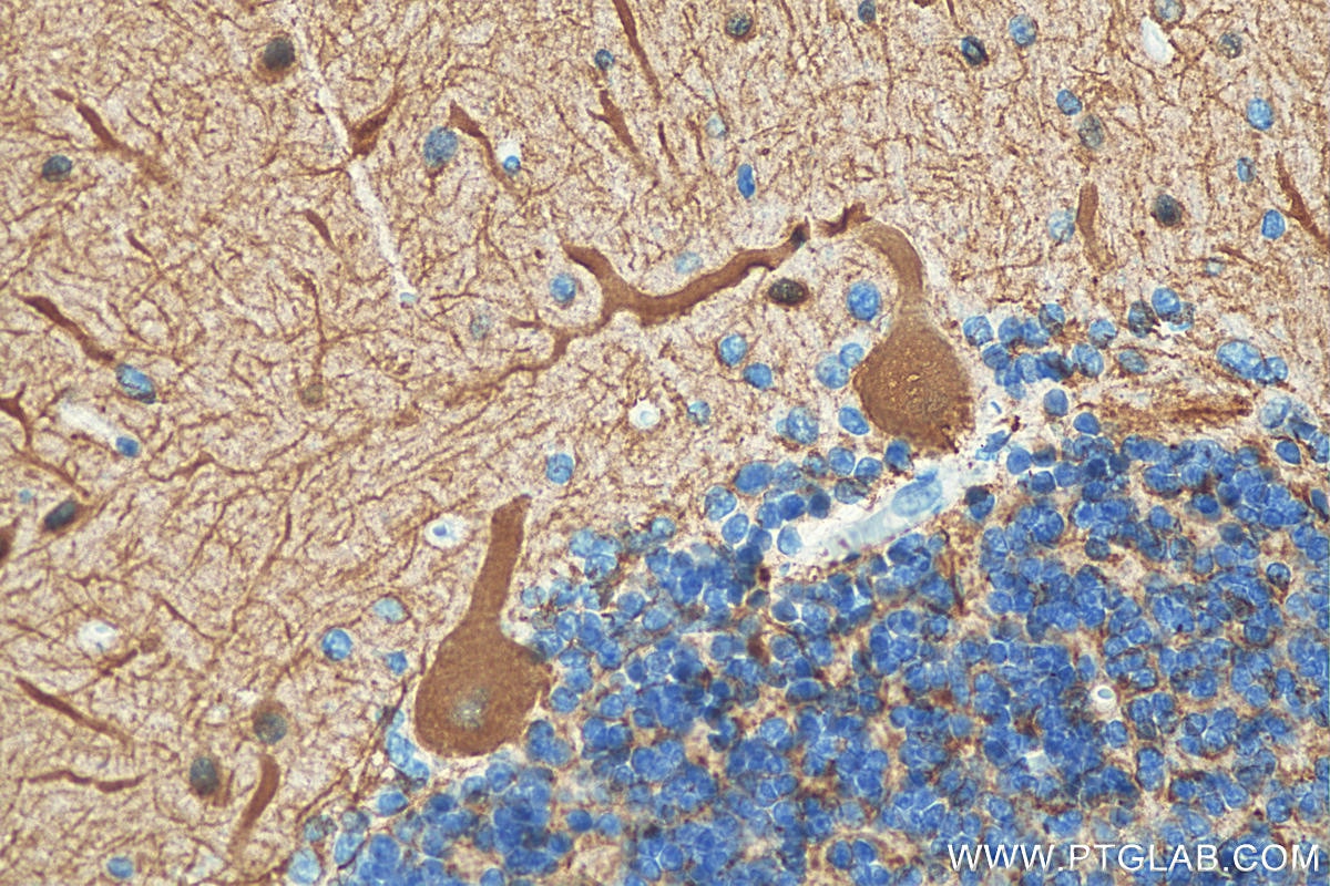 Immunohistochemistry (IHC) staining of human cerebellum tissue using TUBB3-specific/TUJ1 Monoclonal antibody (66375-1-Ig)