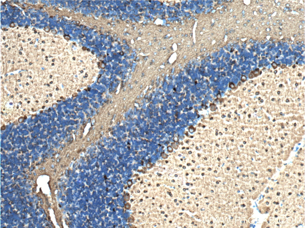 Immunohistochemistry (IHC) staining of mouse cerebellum tissue using TUBB3-specific/TUJ1 Monoclonal antibody (66375-1-Ig)