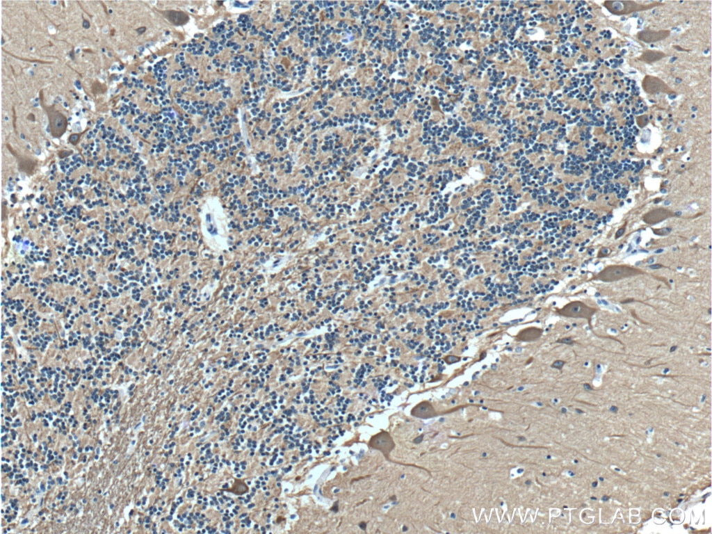 Immunohistochemistry (IHC) staining of human cerebellum tissue using TUBB3-specific Monoclonal antibody (66375-1-Ig)