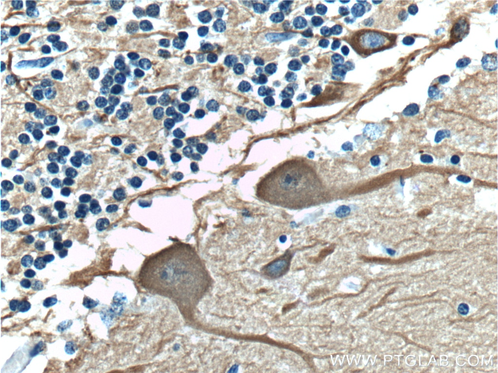 Immunohistochemical analysis of paraffin-embedded human cerebellum tissue slide using 66375-1-Ig (TUBB3-specific Antibody) at dilution of 1:400 (under 40x lens)