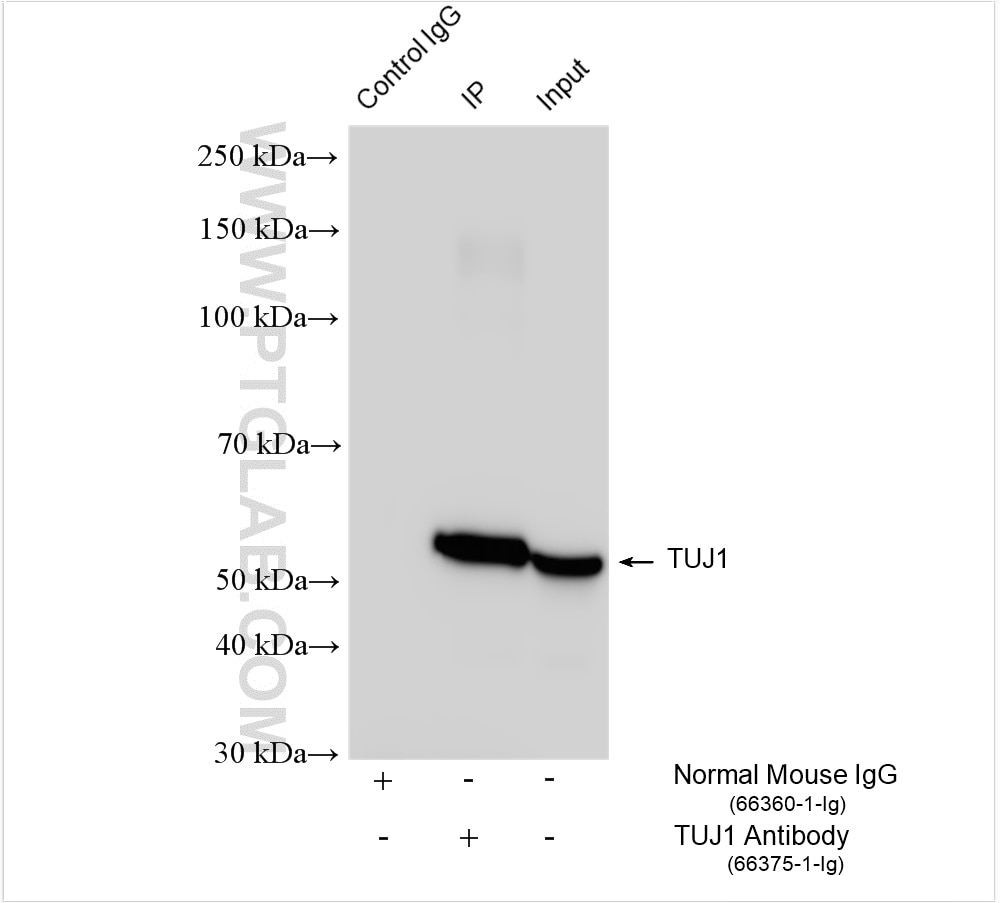 Immunoprecipitation (IP) experiment of SH-SY5Y cells using TUBB3-specific/TUJ1 Monoclonal antibody (66375-1-Ig)