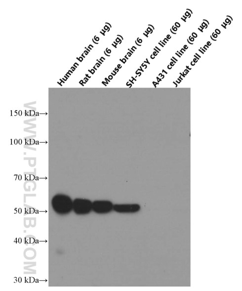 Western Blot (WB) analysis of fetal human brain tissue using TUBB3-specific/TUJ1 Monoclonal antibody (66375-1-Ig)