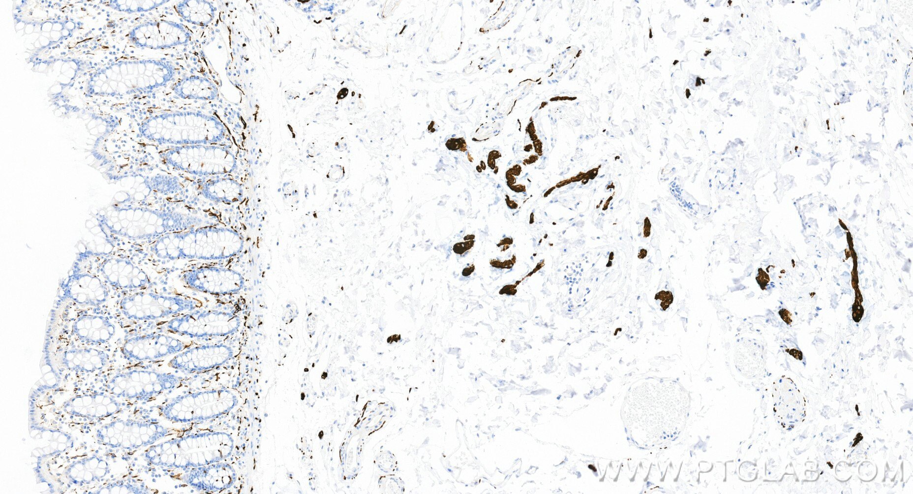 Immunohistochemistry (IHC) staining of human colon tissue using TUBB3-specific/TUJ1 Recombinant monoclonal antibod (80128-3-RR)