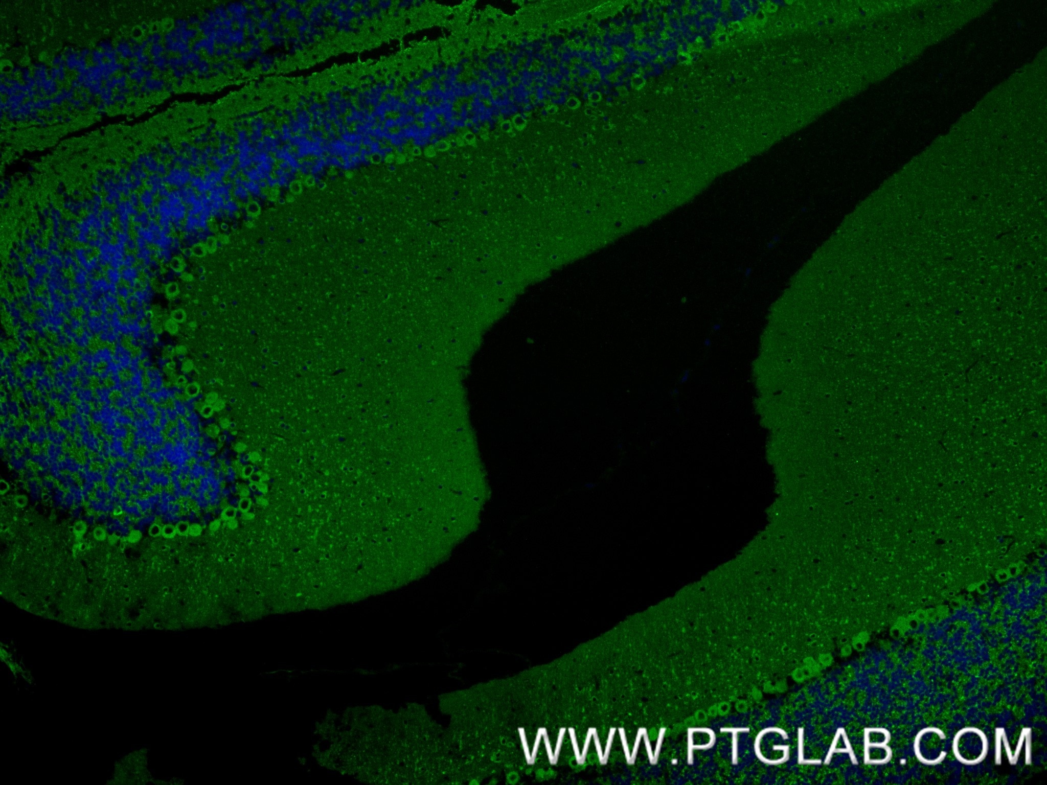 Immunofluorescence (IF) / fluorescent staining of mouse cerebellum tissue using TUBB3-specific/TUJ1 Recombinant antibody (80128-3-RR)