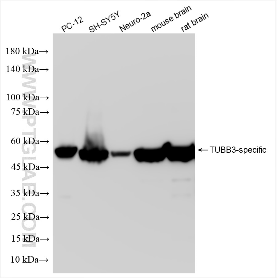 Western Blot (WB) analysis of various lysates using TUBB3-specific/TUJ1 Recombinant antibody (80128-3-RR)