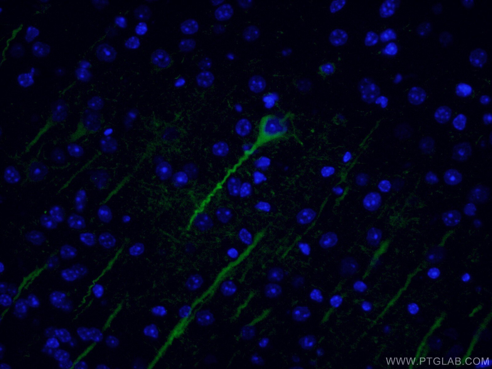 IF Staining of mouse brain using CL488-66375