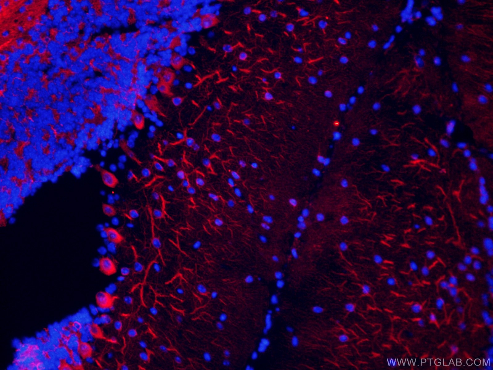 Immunofluorescence (IF) / fluorescent staining of mouse brain tissue using CoraLite®594-conjugated TUBB3-specific Monoclonal  (CL594-66375)