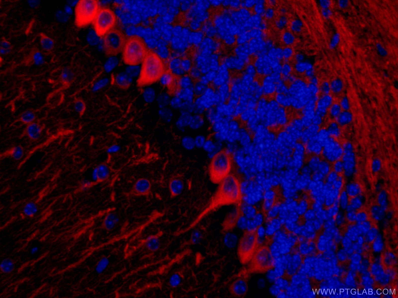 Immunofluorescence (IF) / fluorescent staining of mouse brain tissue using CoraLite®594-conjugated TUBB3-specific Monoclonal  (CL594-66375)