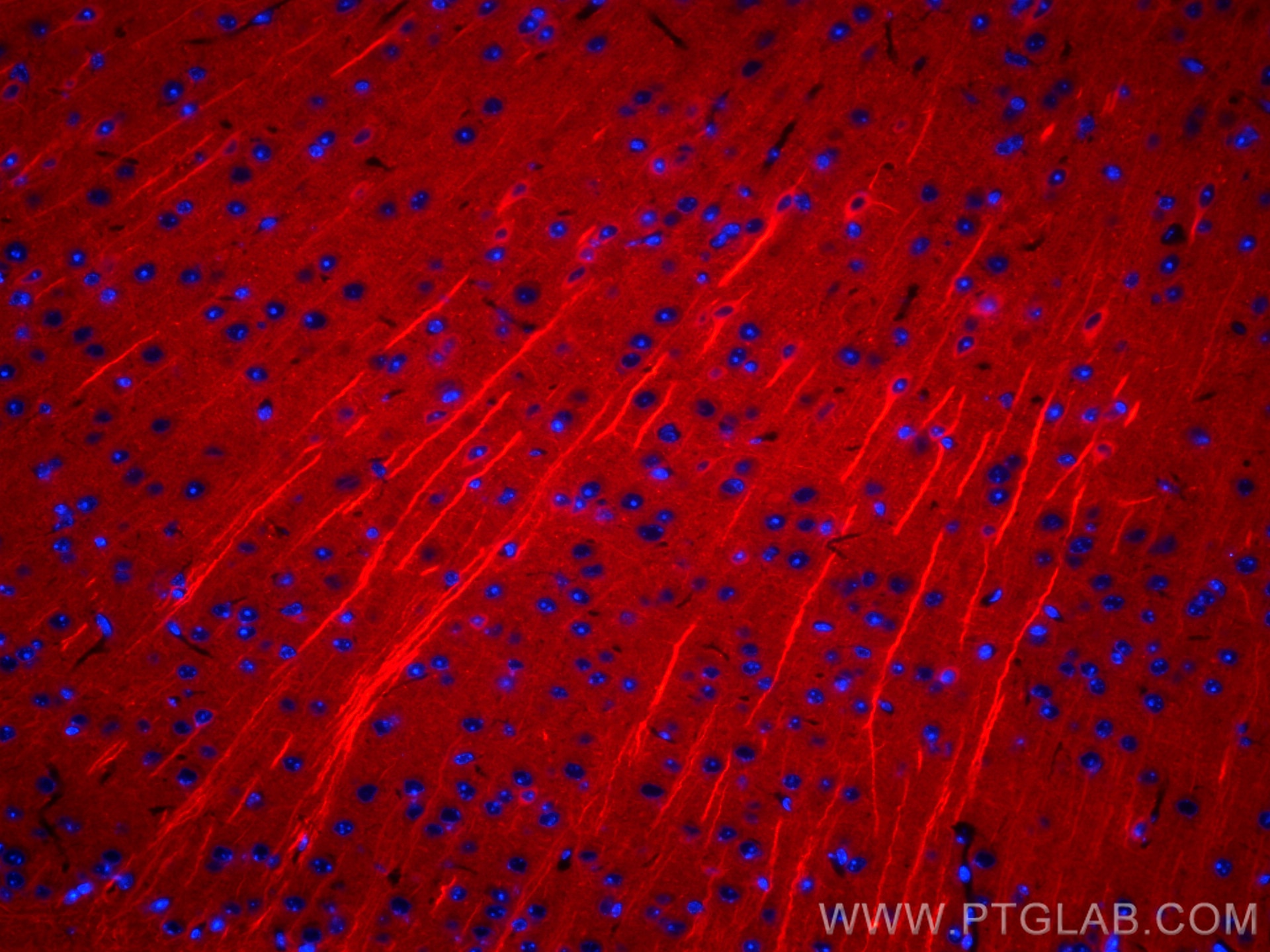 Immunofluorescence (IF) / fluorescent staining of mouse brain tissue using CoraLite®594-conjugated TUBB3-specific/TUJ1 Monocl (CL594-66375)