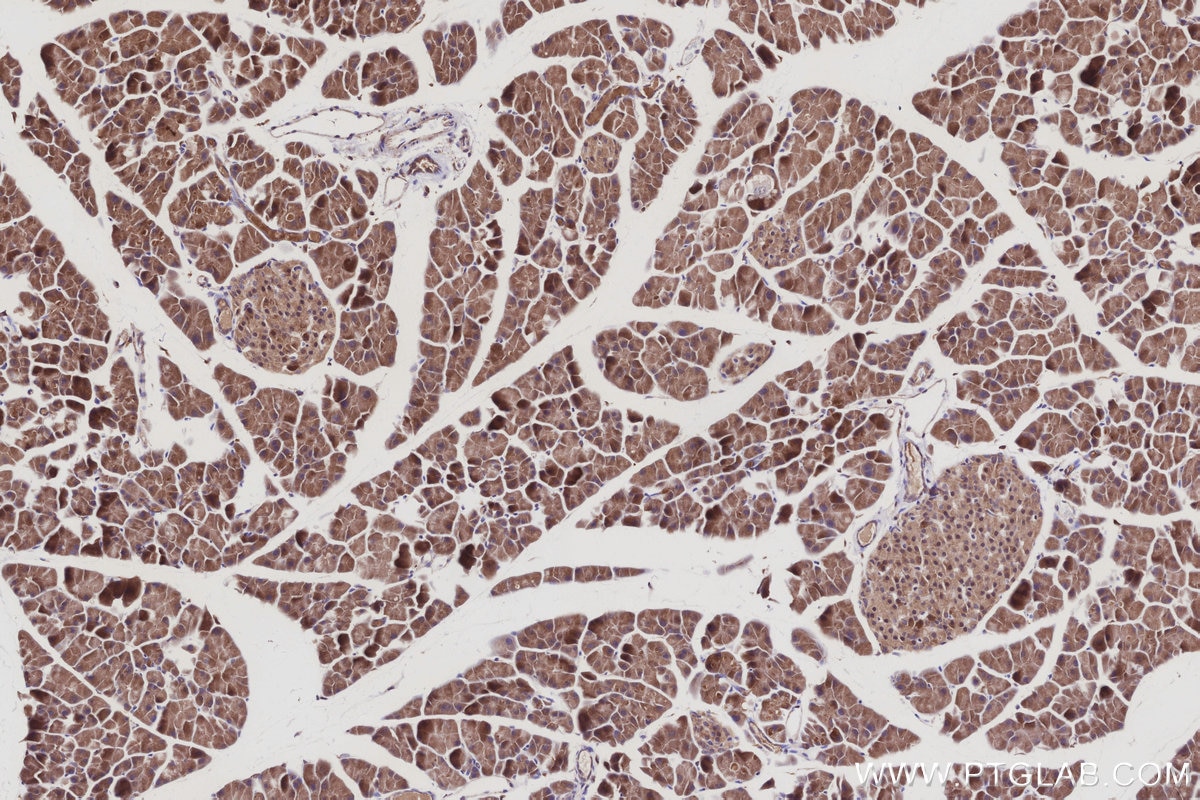 IHC staining of mouse pancreas using 27433-1-AP Immunohistochemistry (IHC) staining of mouse pancreas tissue using TUBD1 Polyclonal antibody (27433-1-AP)