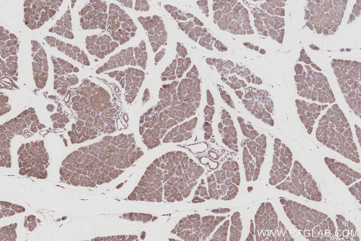 IHC staining of rat pancreas using 27433-1-AP Immunohistochemistry (IHC) staining of rat pancreas tissue using TUBD1 Polyclonal antibody (27433-1-AP)