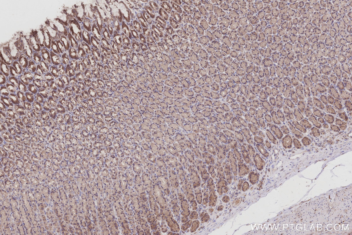 IHC staining of rat stomach using 27433-1-AP Immunohistochemistry (IHC) staining of rat stomach tissue using TUBD1 Polyclonal antibody (27433-1-AP)