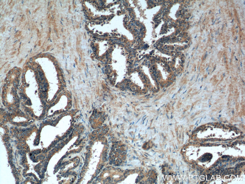 Immunohistochemistry (IHC) staining of human prostate hyperplasia tissue using Gamma Tubulin Polyclonal antibody (15176-1-AP)