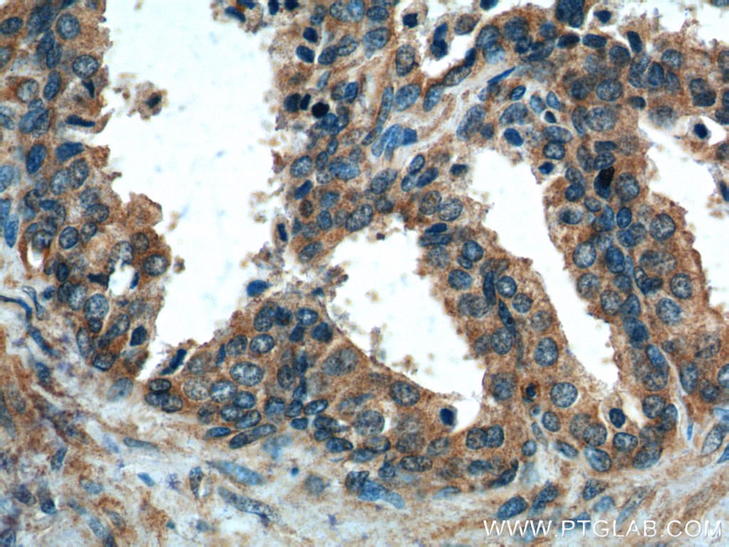 Immunohistochemistry (IHC) staining of human prostate hyperplasia tissue using Gamma Tubulin Polyclonal antibody (15176-1-AP)