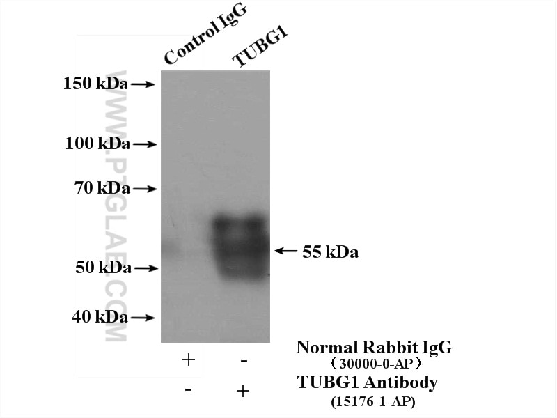 Immunoprecipitation (IP) experiment of HeLa cells using Gamma Tubulin Polyclonal antibody (15176-1-AP)