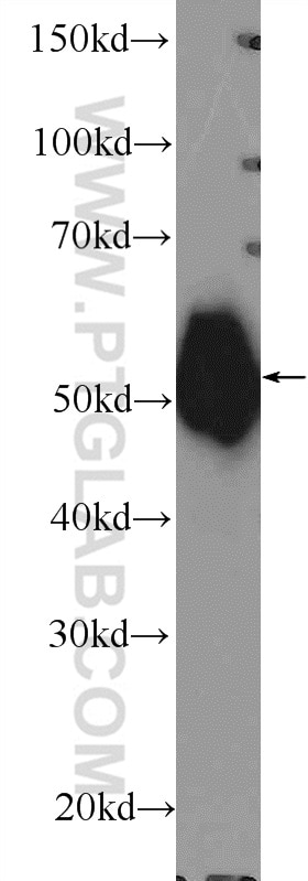 Western Blot (WB) analysis of HeLa cells using Gamma Tubulin Polyclonal antibody (15176-1-AP)