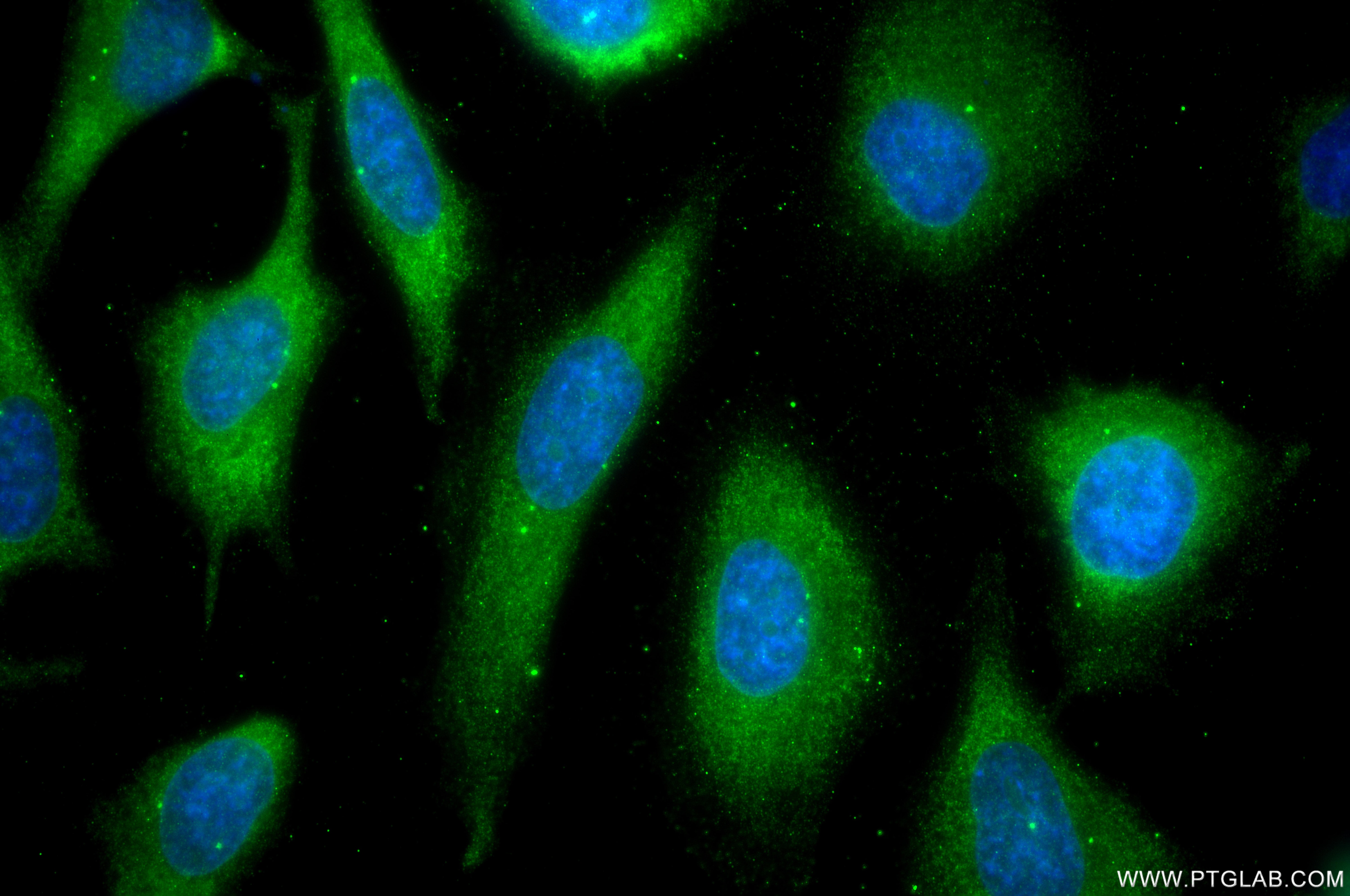 IF Staining of HeLa using 87516-1-RR Immunofluorescence (IF) / fluorescent staining of HeLa cells using TUBG2 Recombinant monoclonal antibody (87516-1-RR)