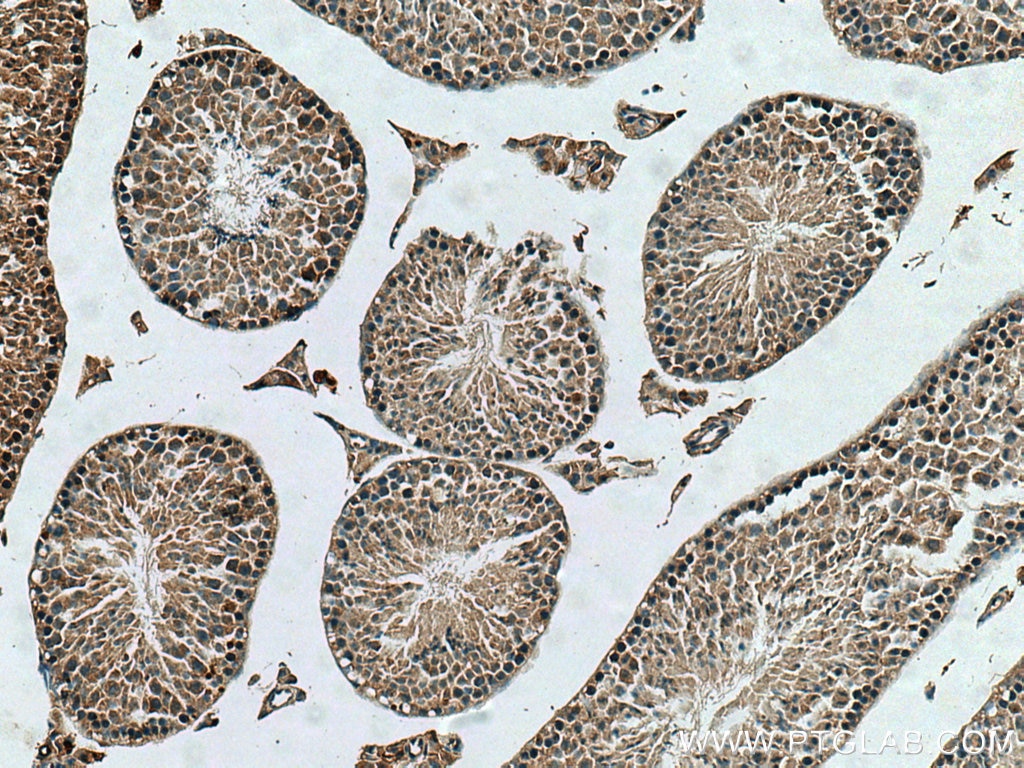 Immunohistochemistry (IHC) staining of mouse testis tissue using TUBGCP2 Polyclonal antibody (25856-1-AP)