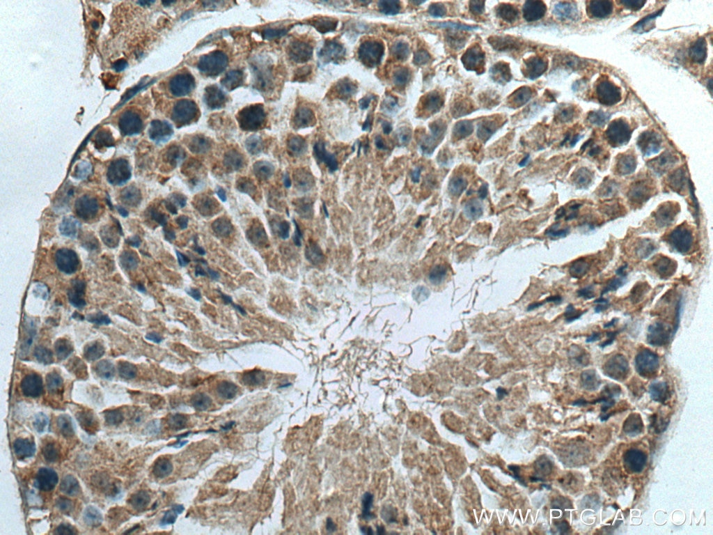 Immunohistochemistry (IHC) staining of mouse testis tissue using TUBGCP2 Polyclonal antibody (25856-1-AP)