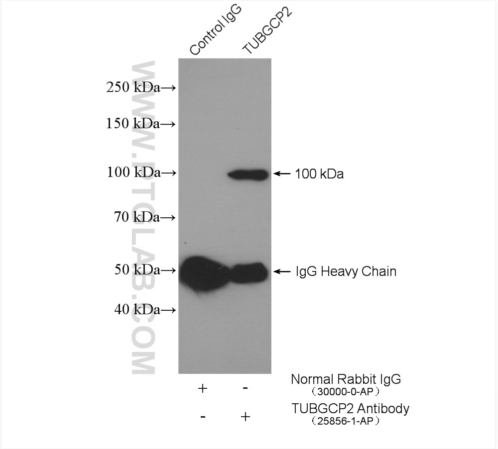 Immunoprecipitation (IP) experiment of HeLa cells using TUBGCP2 Polyclonal antibody (25856-1-AP)