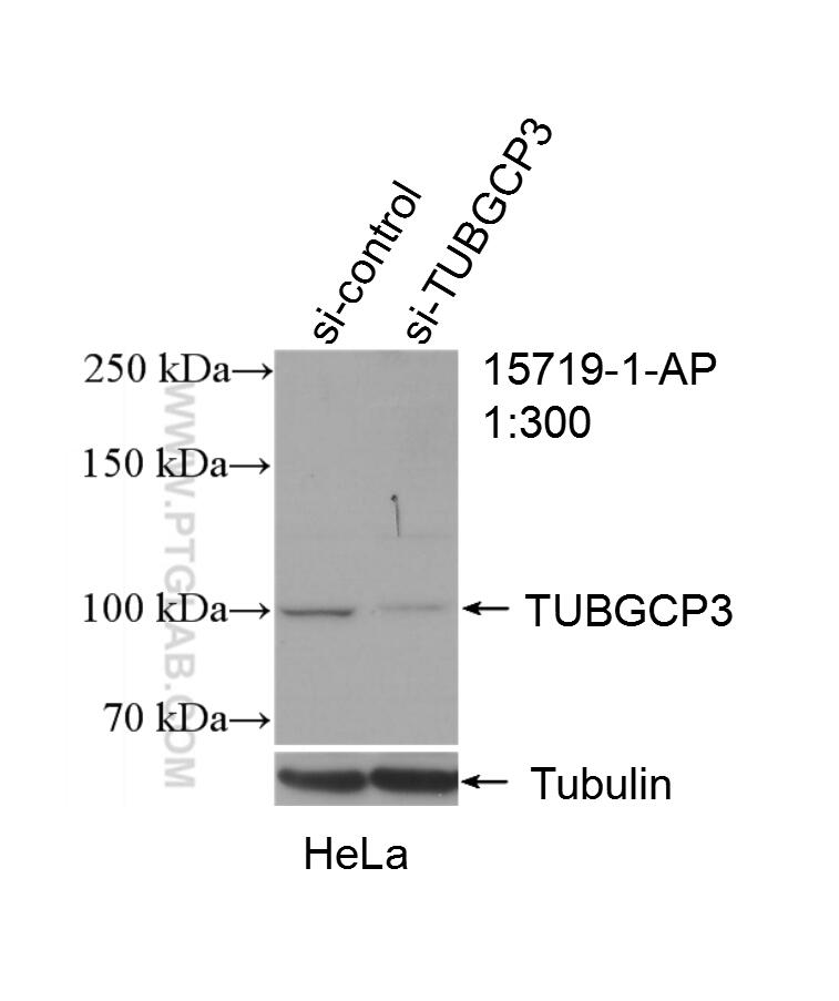 Western Blot (WB) analysis of HeLa cells using TUBGCP3 Polyclonal antibody (15719-1-AP)