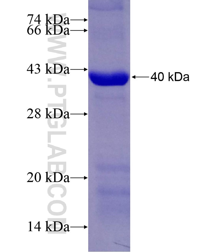 TUBGCP3 fusion protein Ag8424 SDS-PAGE
