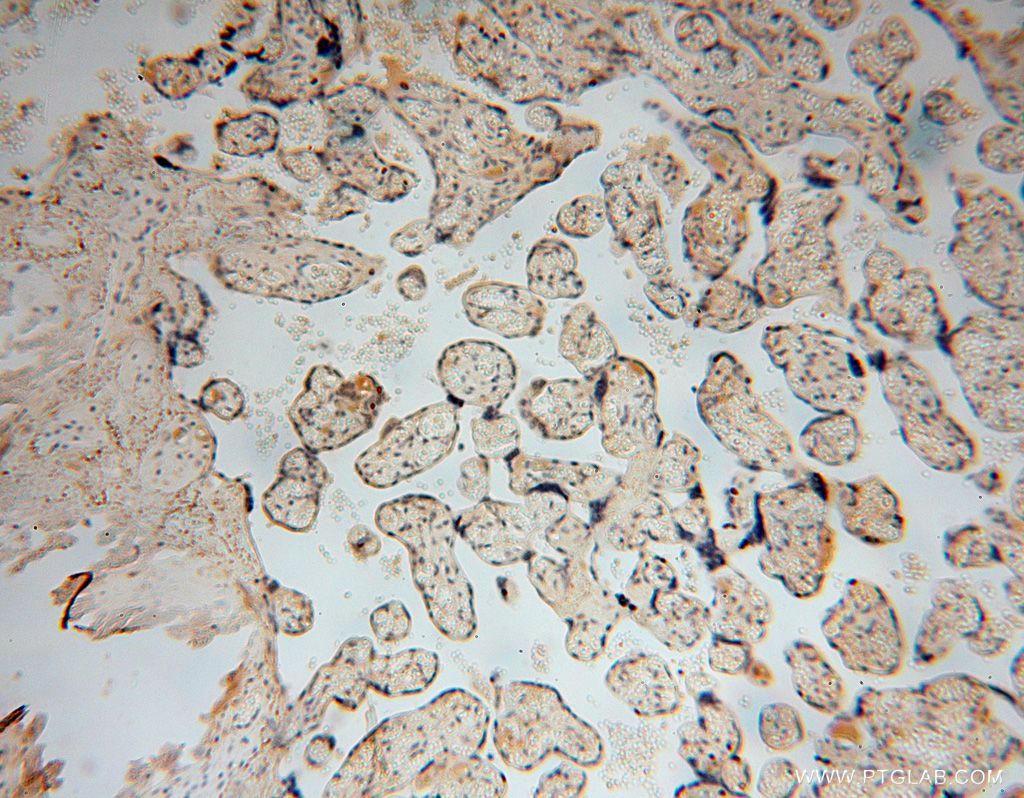Immunohistochemistry (IHC) staining of human placenta tissue using TUBGCP4 Polyclonal antibody (17088-1-AP)