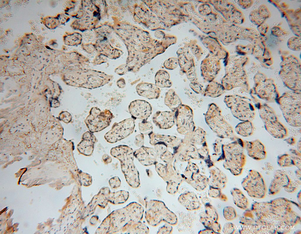 IHC staining of human placenta using 17088-1-AP