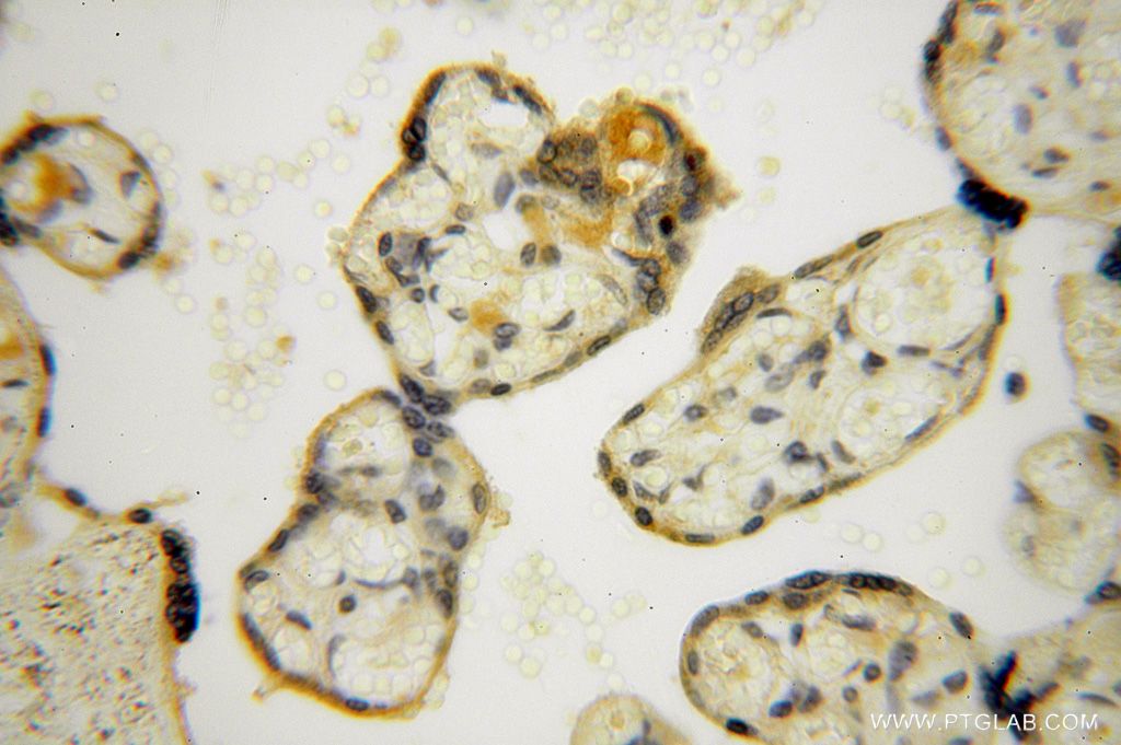 IHC staining of human placenta using 17088-1-AP