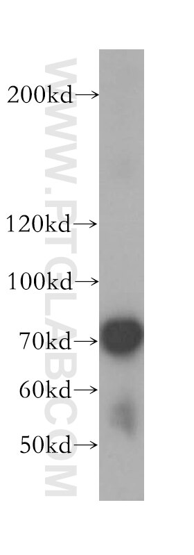 Western Blot (WB) analysis of MCF-7 cells using TUBGCP4 Polyclonal antibody (17088-1-AP)