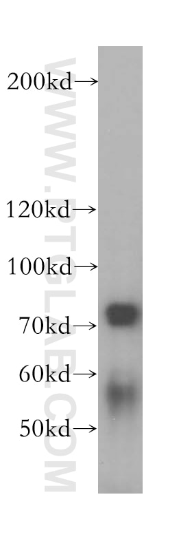 Western Blot (WB) analysis of HepG2 cells using TUBGCP4 Polyclonal antibody (17088-1-AP)
